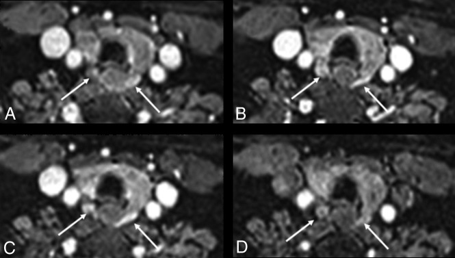 Fig 1.