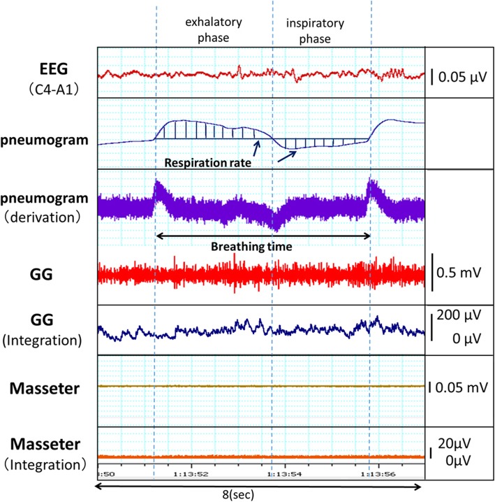 Fig. 3
