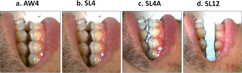 Fig. 4