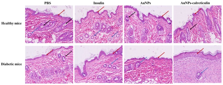 Figure 11