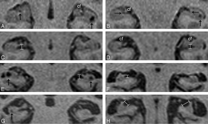 Fig 1.