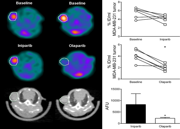 Initial preclinical PET studies of 18F fluorthanatrace (18F-FTT) demonstrate the ability of the radiotracer to measure occupancy of a poly (adenosine diphosphate–ribose) polymerase inhibitor (PARPi). MDA-MB-231 tumor–bearing female athymic nude mice (n = 25) were injected with 18F-FTT (11.4 MBq ± 0.5), showing baseline tumor uptake (indicated by the circle showing the position of the tumor). The tracer uptake was blocked by the administration of olaparib (n = 14), a known PARPi, but not by iniparib (n = 11), as shown on the images (left panel) and the quantitative measurement as presented as percentage of injected dose per milliliter (right panel). Iniparib has no inhibitory effect on PARP-1 activity.