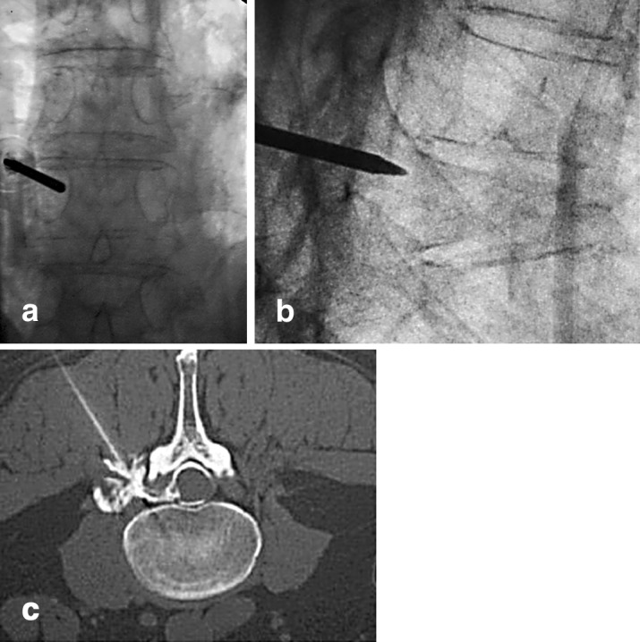 Fig. 1. a,b