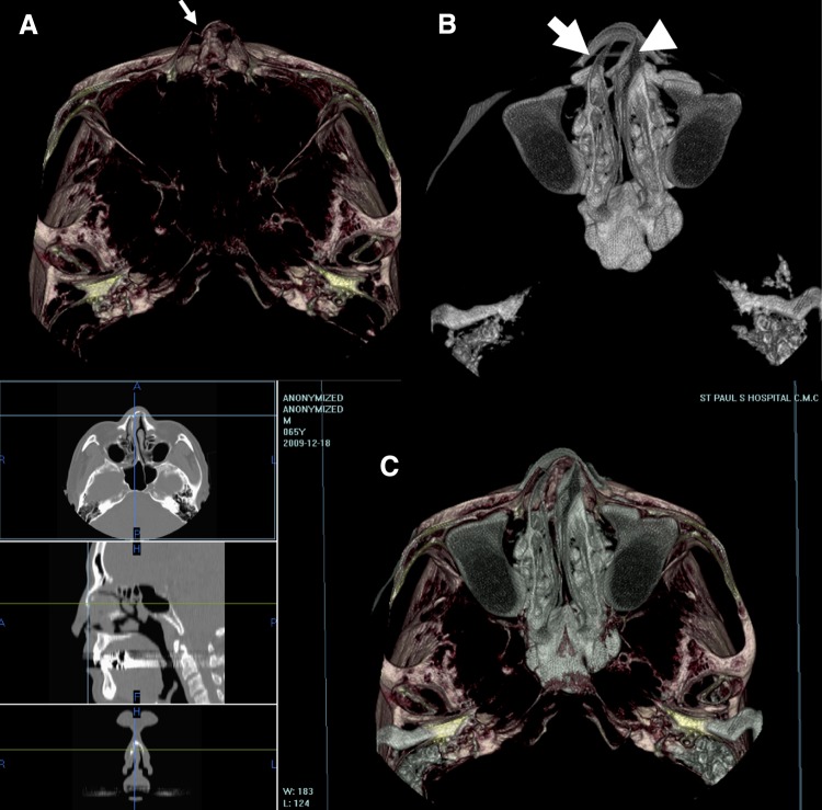 Fig. 4