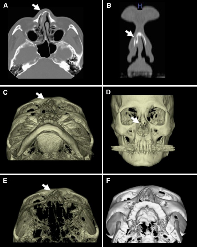 Fig. 3