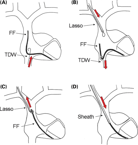 Figure 2