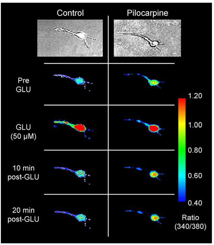 Fig. 11