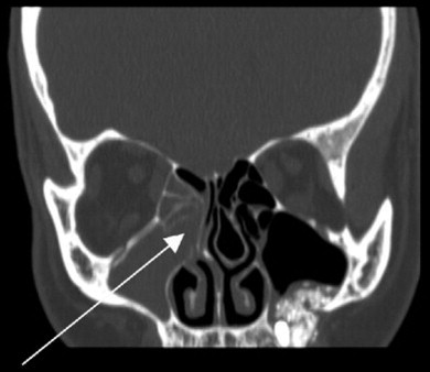 Fig. 6.3