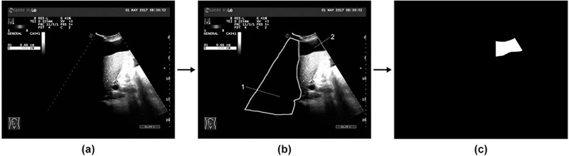 FIGURE 2