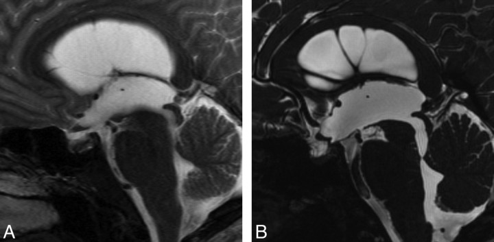 Fig 3.