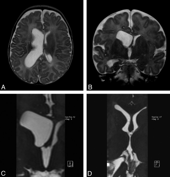 Fig 5.