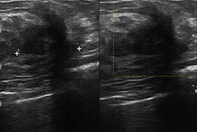 Fig. 5