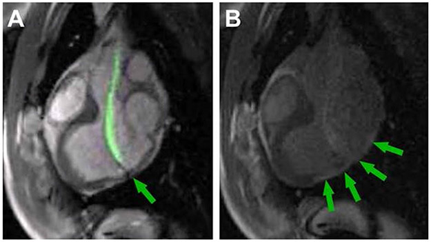 Fig. 5