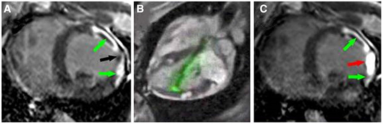 Fig. 6