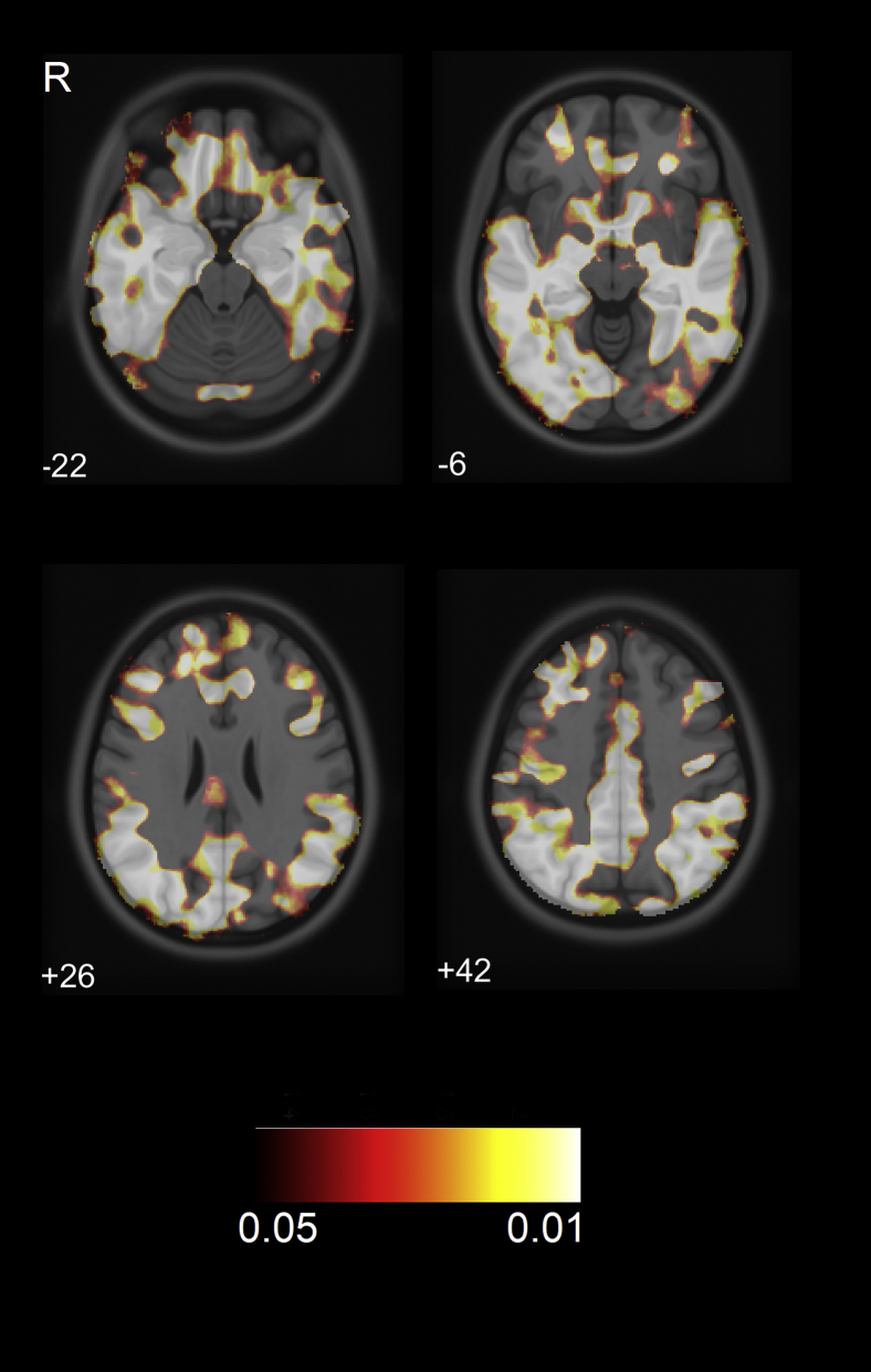 Fig. 1