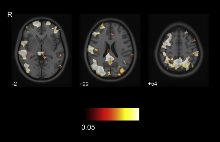 Fig. 3