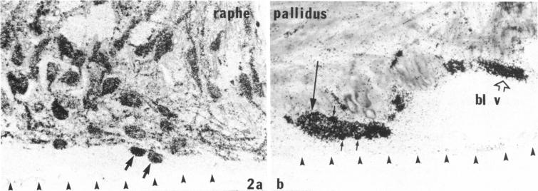 graphic file with name pnas00361-0304-a.jpg