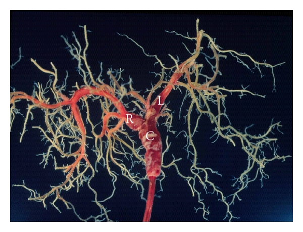 Tutorial Review for Understanding of Cholangiopathy - PMC