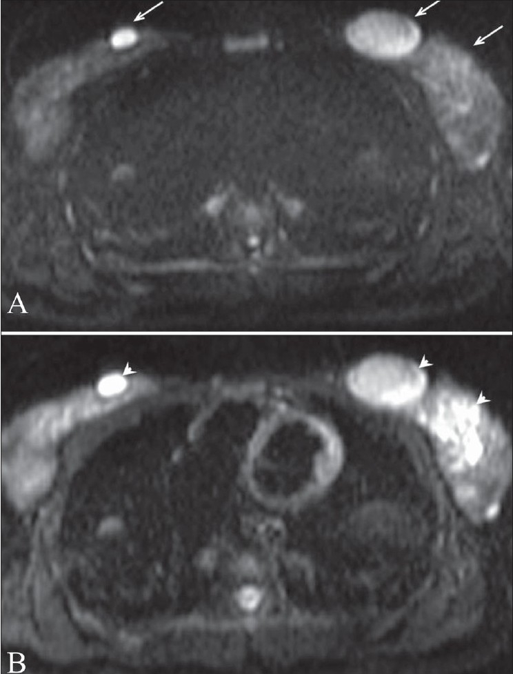 Figure 2 (A,B):