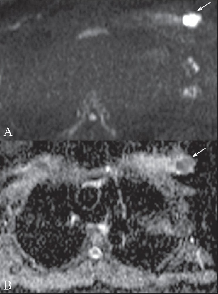 Figure 1 (A,B):