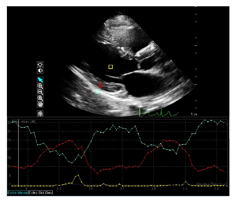 Figure 2