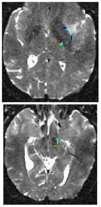 Fig. 4