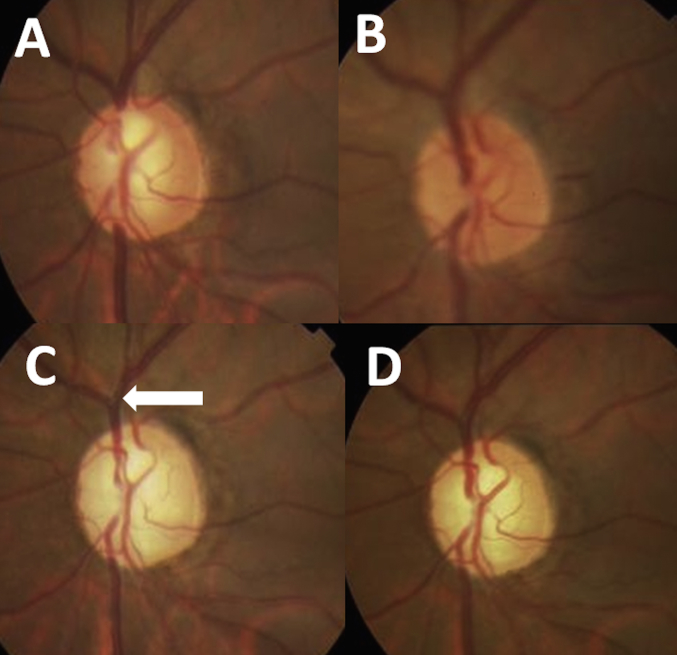 Fig. 1