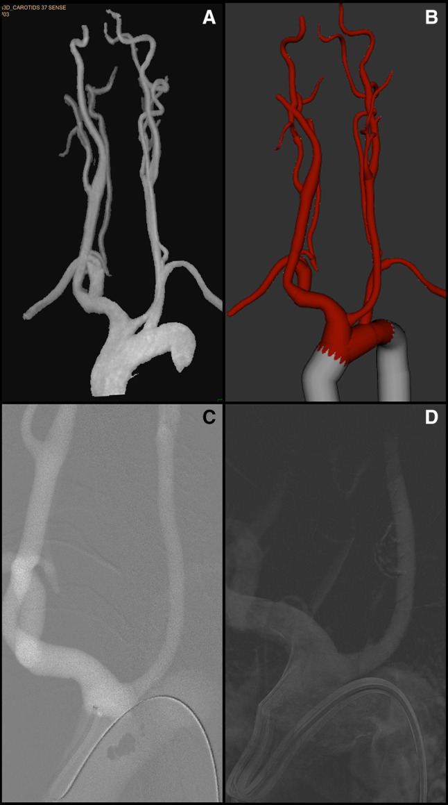 Fig. 1