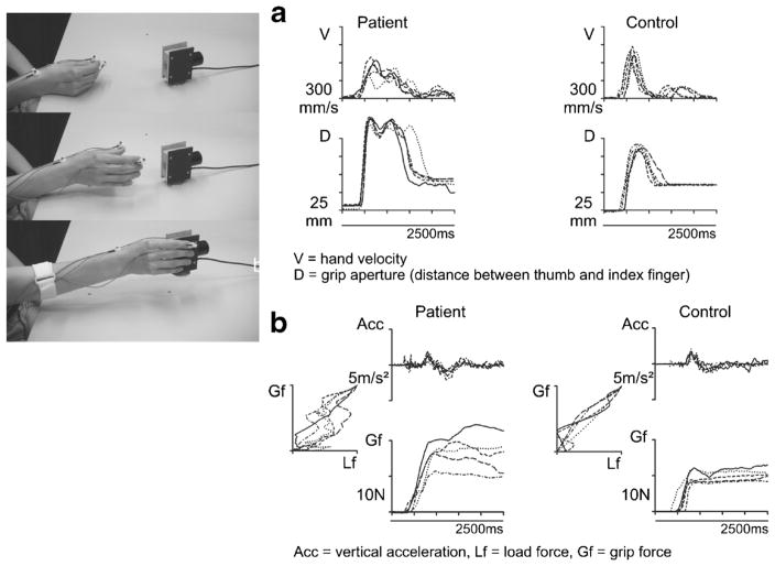 Fig. 3