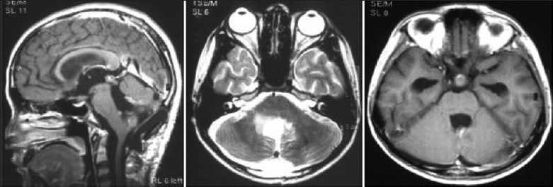 Figure 18b