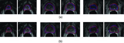 FIG. 13.