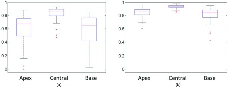 FIG. 14.