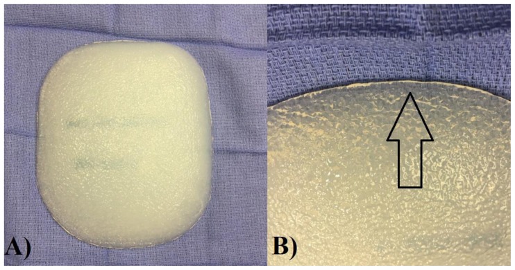 Figure 10