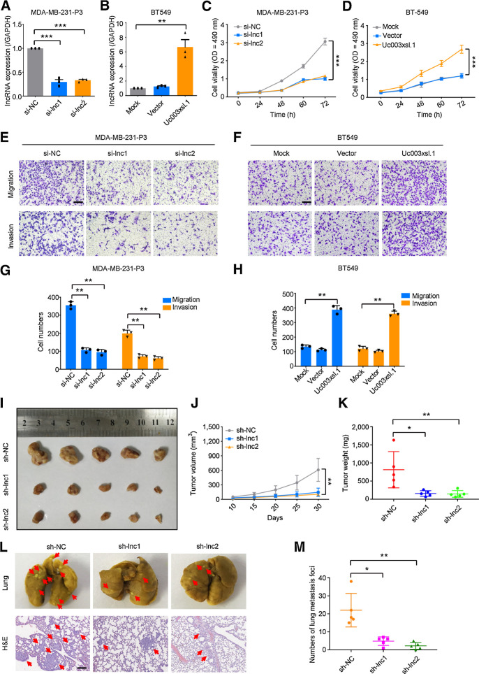 Figure 2. Uc003xsl.1 promotes proliferation, migration, and invasion of TNBC cells. A and B, The efficiency of Uc003xsl.1 knockdown in MDA-MB-231-P3 cells (A) and overexpression in BT549 cells (B) was verified by qRT-PCR. C and D, Cell viability after Uc003xsl.1 knockdown in MDA-MB-231-P3 cells (C) and overexpression in BT549 cells (D) was assessed by MTS assays. E–H, Representative images and histogram analysis of transwell assays after Uc003xsl.1 knockdown in MDA-MB-231-P3 cells (E and G) and overexpression in BT549 cells (F and H). Scale bars, 100 μm. I, Gross appearance of xenograft tumors after subcutaneous injections with sh-NC, sh-lnc1, and sh-lnc2 groups (n = 5). J and K, Tumor volumes (J) and weights (K) were measured in the indicated groups (n = 5). L, Representative images of lung colonization and H&E staining of lung sections after injection of MDA-MB-231-P3 cells with sh-NC, sh-lnc1, and sh-lnc2 groups into tail veins of mice (n = 5). Scale bars, 100 μm. M, Histogram analysis for the number of metastatic foci representing lung metastasis (n = 5). Error bars, SDs of three independent experiments. *, P < 0.05; **, P < 0.01; ***, P < 0.001.