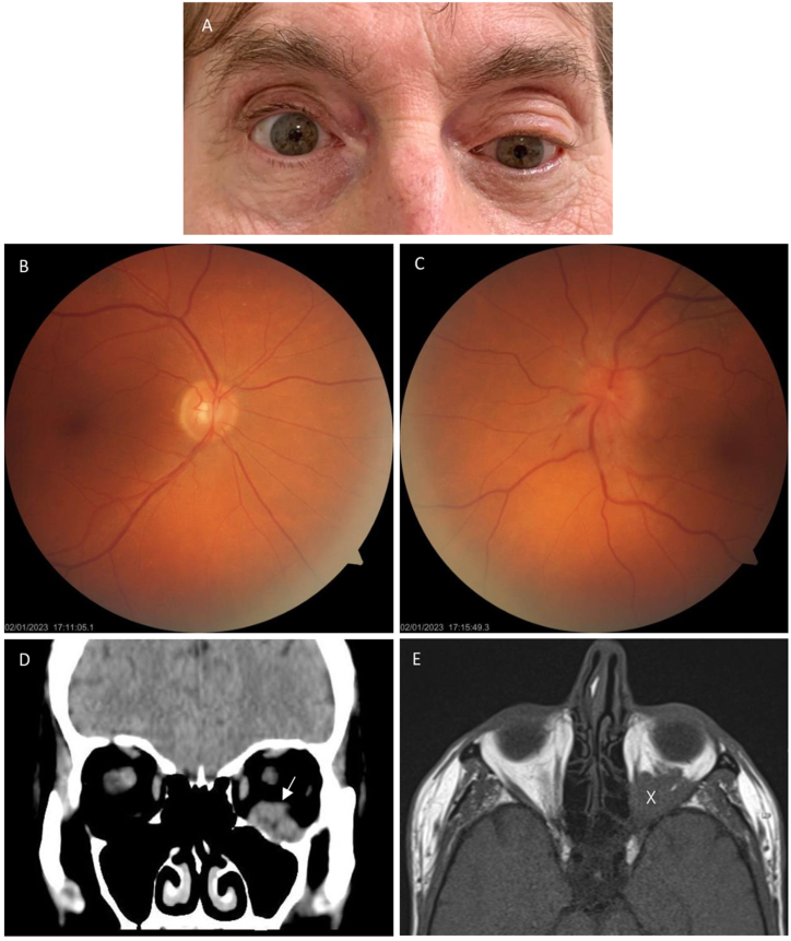 Fig. 1