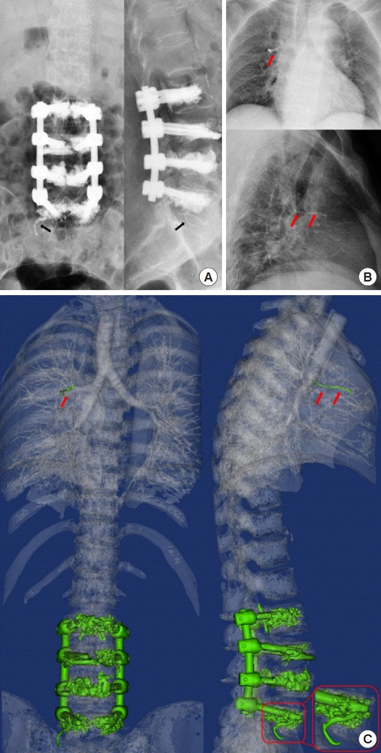 Fig. 2.