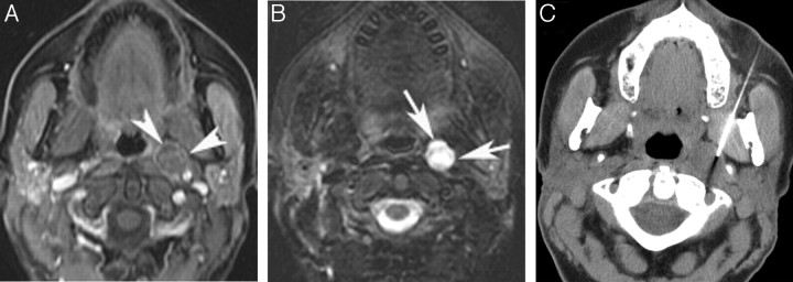 Fig 3.