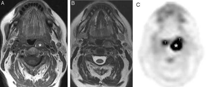 Fig 1.