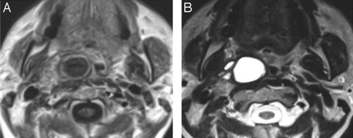 Fig 2.