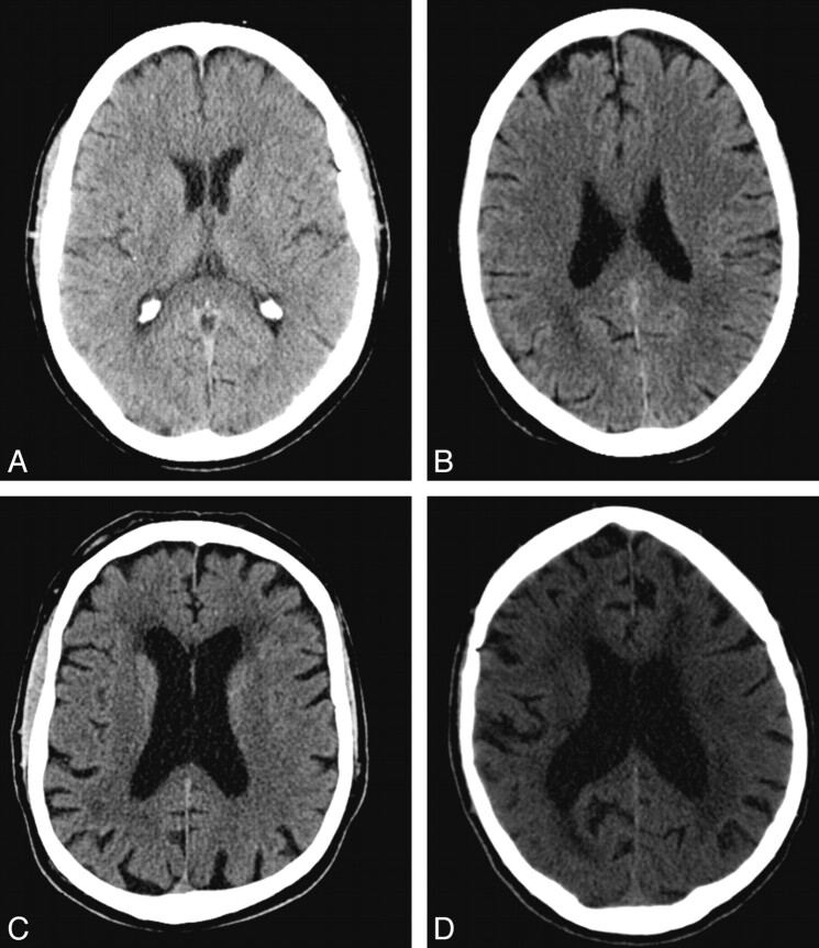 Fig 1.