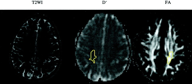 Fig 3.