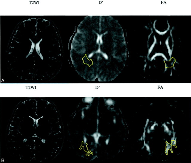 Fig 2.