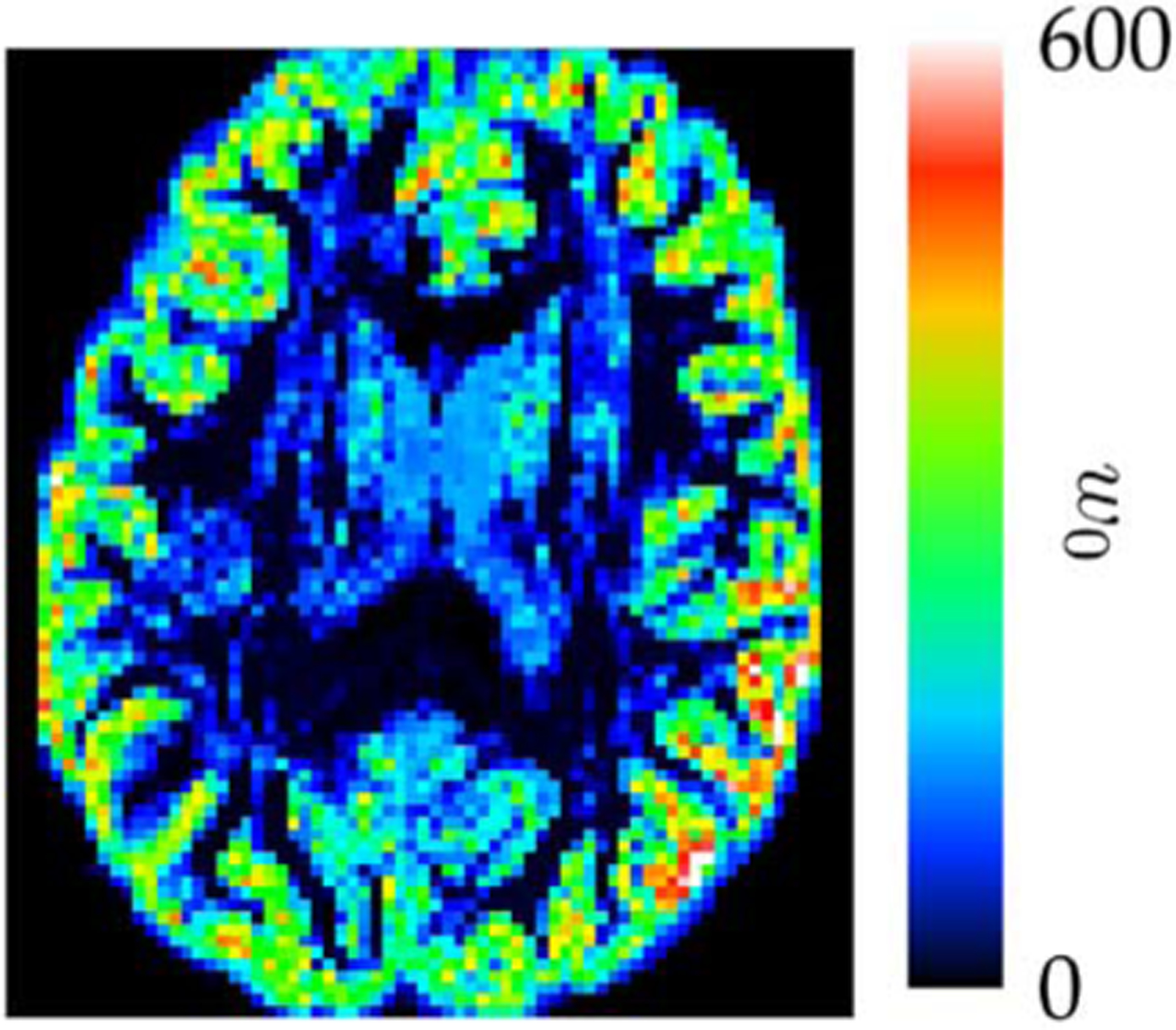 Fig. 13.