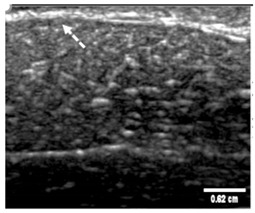 graphic file with name polymers-14-00722-i009.jpg