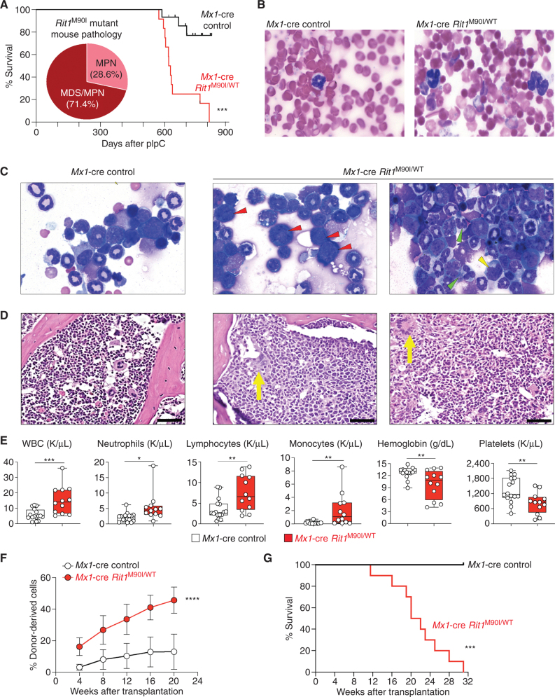 Figure 4. Rit1M90I/WT mutation drives the development of myeloid neoplasms in vivo. A, Kaplan–Meier curve of primary Mx1-cre Rit1M90I/WT mice following polyinosinic:polycytidylic acid (pIpC) treatment. Venn diagram indicates diagnoses of Rit1M90/+ mice at the time of death and proportion developing MPN and myelodysplasia/MPN (MDS/MPN). n = 12. ***, P < 0.001. Wright–Giemsa stain of peripheral blood (B) and bone marrow (C) cytospins of Mx1-cre control and Mx1-cre Rit1M90I/WT mice at the time of disease onset of the Rit1M90I/WT mice. Red arrows indicate dysplastic erythroid precursors. Green arrows indicate dysplastic neutrophils. Yellow arrow indicates dysplastic myeloid precursors. Two representative animals are shown for the Rit1M90I/WT mice. D, Hematoxylin–eosin stain of bone marrow (yellow arrows indicate dysplastic megakaryocytes; scale bars = 100 μm). Two representative animals are shown for the Rit1M90I/WT mice. E, Box-and-whisker plots of peripheral blood counts of primary Mx1-cre Rit1M90I/WT mice and their age-matched Mx1-cre control mice from A. For box-and-whisker plots, bar indicates median; box edges, first and third quartile values; and whisker edges, minimum and maximum values. n = 12. *, P < 0.05; **, P < 0.01; ***, P < 0.001. WBC, white blood cell. F, The percentage of CD45.2+ cells in peripheral blood of sublethally irradiated CD45.1+ recipient mice following transplantation of Mx1-cre Rit1M90/WT bone marrow cells from the time of disease onset from D. n = 5–10. Mean ± SD. ****, P < 0.001. G, Kaplan–Meier curve of CD45.1 recipient mice from F. n = 5–10. ***, P < 0.001.