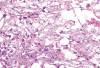 Fig. 15.