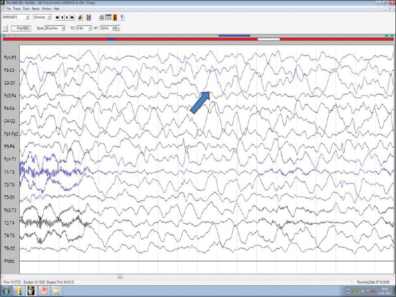 Figure 9