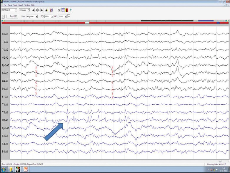 Figure 5