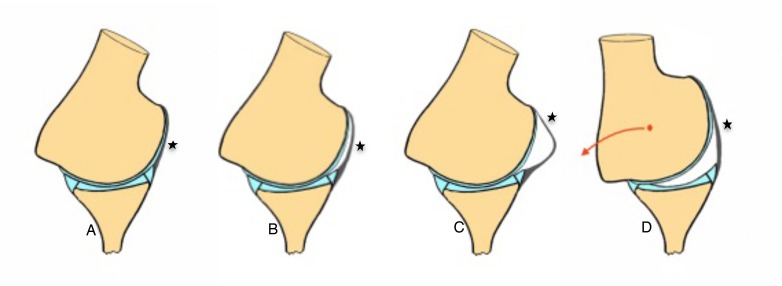 Fig. (10)