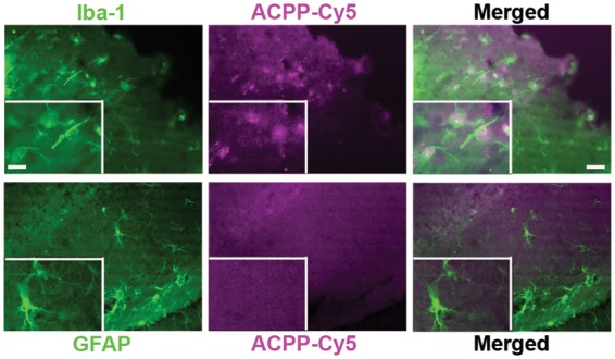 Gelatinase activity imaged by activatable cell-penetrating peptides in ...